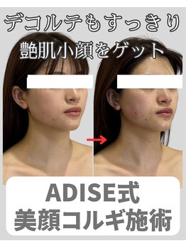 アディス 心斎橋(ADISE)/ADISE式コルギで艶小顔が叶う！