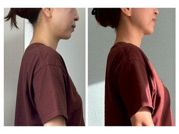 テルケル 佐賀/