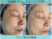 リメイククリニカルビューティー(Remake clinical beauty)/