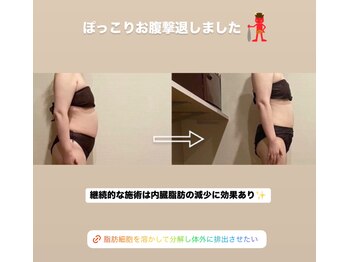 トトノエル(TOTONOEL)/ぽっこりお腹撃退