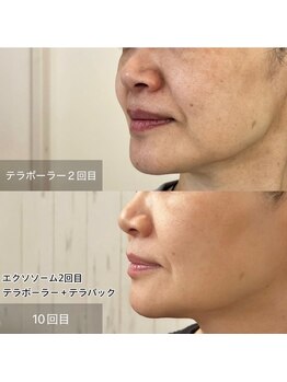 ファソ ブロウアンドアイズ(fasol)/鏡を見るのが楽しくなる毎日へ