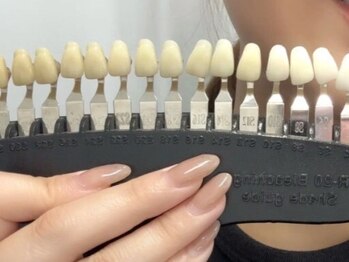 ホワイトニングバー 心斎橋オーパ店の写真/【月額制ホワイトニング通い放題】“理想の白さ”をキープ