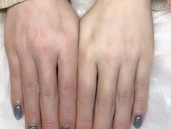 トリーシア(Nail & Beauty Salon Tri-xia)の写真/【指先から叶える、極上うるおい再生ケア¥5500】手荒れにお悩みの方向け、スペシャルハンドケアコース♪