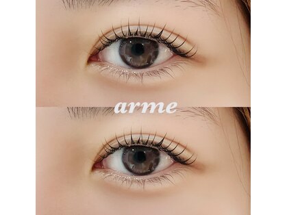 アルム(arme)の写真