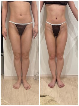 ありひ/セルゼロ下半身