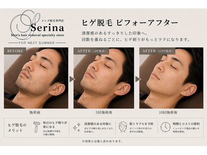 セリナ(SERINA)の写真