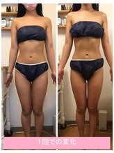 ルピナージュ(Lupinage)/ビフォーアフター