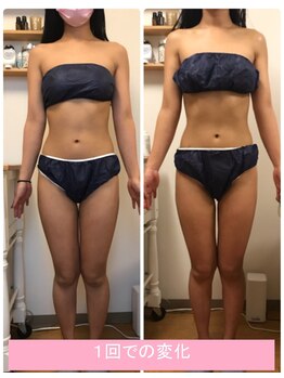 ルピナージュ(Lupinage)/ビフォーアフター