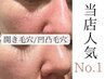 No1【毛穴埋める厚化粧は卒業】開き毛穴/凹凸毛穴◎毛穴レス肌コース初回体験