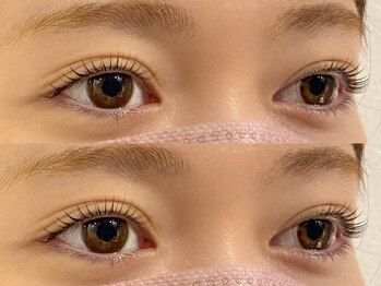 スー(Suu.)/100種類以上のロッドからご提案