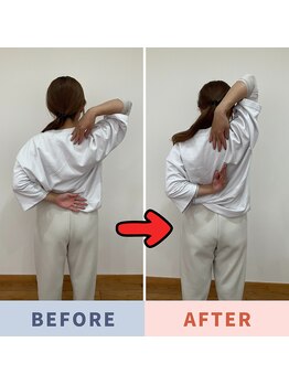 Nストレッチ/【圧倒的変化】肩こり改善