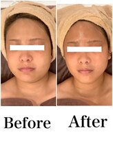 スペチアーレ 夙川/不動の大人気メニューで小顔に