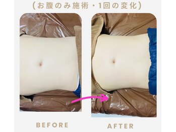 ネオボディ(Neo Body)/短時間で贅沢な変化を♪