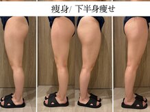 サンオーラ(SUN AURA)/長年のお悩みも改善