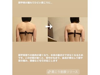 トトノエル(TOTONOEL)/肩甲骨はがし