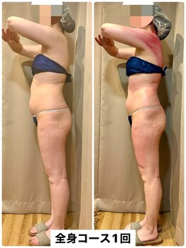 スピード美人 本八幡店/運動が苦手な方でも痩せれます