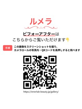 インナーラボ 心斎橋(InnerLab)/ルメラ｜ビフォーアフター集