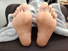 フィールソーグッド(feel so good)/フットケア（施術前）