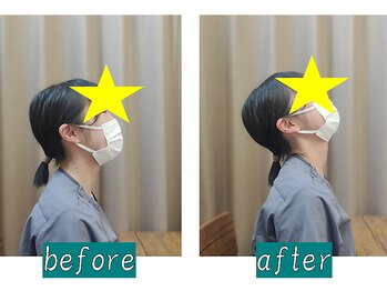 奏流(soryu)/固まった首が上を向けるように♪