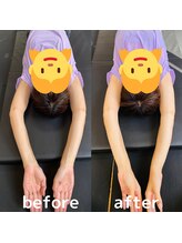 オアボディ(orBody)/姿勢改善ビフォー・アフター18