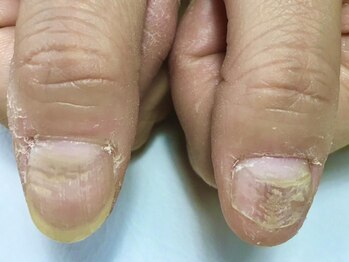ネイルリノの写真/【ダメージネイルケアインストラクター】のオーナーだから叶う自爪育成コース！爪コンプレックスの解消◎