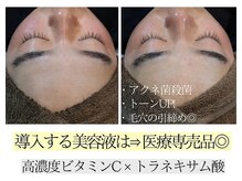 アースコアフュールボーテ ひたち野うしく店(EARTH coiffure beaute)/プラズマシャワー 美容液導入♪