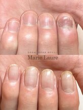 マリーロール 淀屋橋本店(Marie Laure)/深爪矯正/自爪育成/ネイルケア