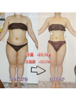 ボディグロス 梅田店(BODY GLOSS)/VIPセレブ2年ー26.7kg