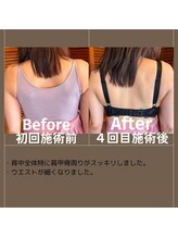 エミニナル(EMININAL)/バストケア【ビフォーアフター】