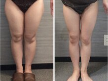 美容整体 ウェリナ 蟹江院/小顔矯正/骨盤矯正/美脚サロン