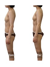 ベンザイ 新潟店(BENZAI)/巻肩、ストレートネックが整う