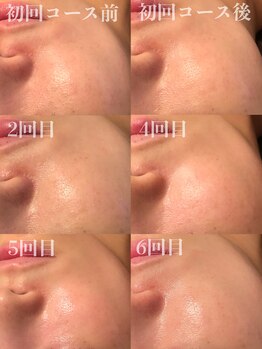 タマンサリ(Taman Sari)/3ヶ月集中プログラム