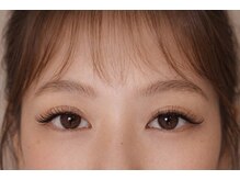 チック(chick)/LEDフラットボリューム◇100束