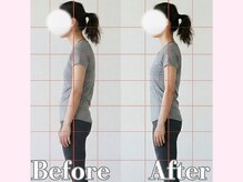 アルピラティス 池尻大橋(AruPilates)/【お客様の変化】首肩/猫背★