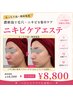 【ニキビケア】毛穴洗浄×濃密泡エステ 通常通常￥16,500→￥8,800