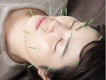 坂田鍼灸治療院/美容鍼水素吸入【板橋/新板橋】