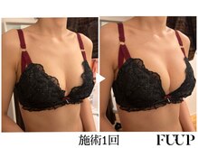 フーアップ 北千住(FU-UP)/バストアップ/育乳（1回）