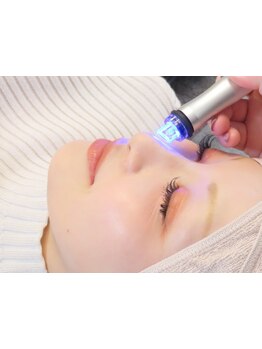 小顔になりたい