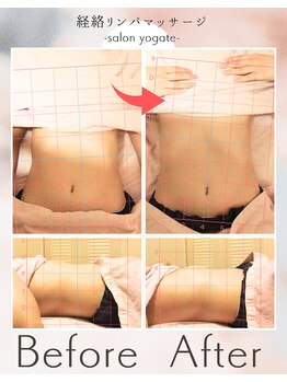 ヨギート(yogate)/リンパ/骨盤矯正/ヘッドスパ 