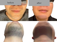 アンピール(Empire)