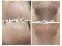 ミーラブ 鹿児島(miilove)