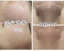 ミーラブ 鹿児島(miilove)