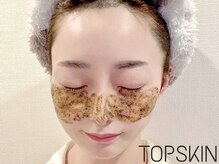 トップスキン 名駅(TOPSKIN)/ハーブピーリング専門店 TOPSKIN