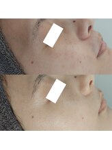 ヴェルシック(Belchic)/くすみと小ジワを同時に改善