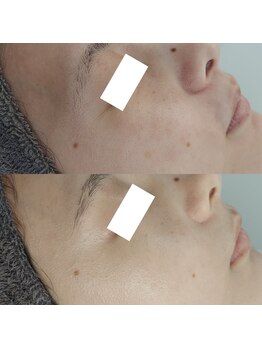 ヴェルシック(Belchic)/くすみと小ジワを同時に改善