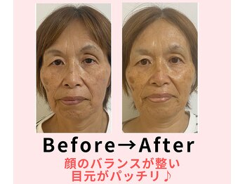 ココロ(COCORO)/美脳小顔矯正&毛穴洗浄