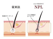 毛周期に関係なく通える！バルジ領域をターゲットにした最新NPL式脱毛