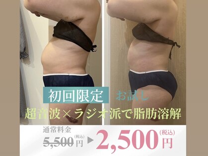 アールワイ(RY)の写真