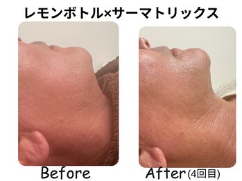 ラディアント たまプラーザ/レモンボトル×サーマトリックス