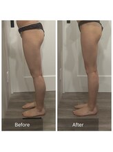 トータルビューティ リライフ(Total beauty Relife)/ウルトランス下半身